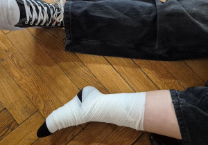 Uczennica z opatrzoną nogą.